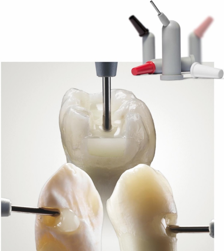 SDR Plus Refill compozit flow Dentsply Sirona carpula compule 0,25g 5 buc SDR Plus Refill compozit flow Dentsply Sirona carpula compule 0,25g 5 buc - imagine 2