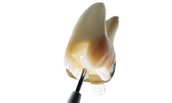 SDR Plus Refill compozit flow Dentsply Sirona carpula compule 0,25g 5 buc SDR Plus Refill compozit flow Dentsply Sirona carpula compule 0,25g 5 buc - imagine 4