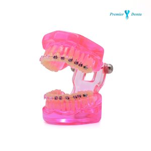 model-typodont-orto-albastru-cu-bracketi-ceramici-si-metalici 1
