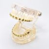 Model typodont orto transparent bracketi metalici tipodont