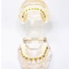 Model typodont orto transparent bracketi metalici tipodont