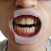 Departator de buze O-type circular