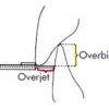 Subler medical intraoral implantologie ortodontie