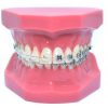 Model typodont orto roz cu bracketi metalici și ceramici
