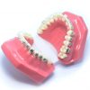 Model typodont orto roz cu bracketi metalici și ceramici