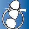Inel "MD" mezio-distal fixator pentru matrici interdentare 1167