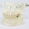 Model typodont orto transparent cu bracketi ceramici