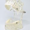 Model typodont orto transparent cu bracketi ceramici