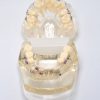 Model typodont orto patologic dinti malpozitionati tipodont tip 1