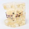 Model typodont orto patologic dinti malpozitionati tipodont tip 1