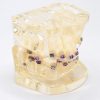 Model typodont orto patologic dinti malpozitionati tipodont tip 1
