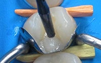 Premierdenta - Premier Denta