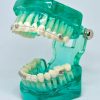 Model typodont orto semitransparent cu bracketi ceramici si metalici