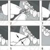 Matrici de celuloid, preconturate, asortate 1096