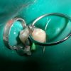 Matrici metalice interdentare tip PALODENT mici 10971(50)