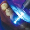 Icuri pene interdentare plastic transparent 1820 80 buc