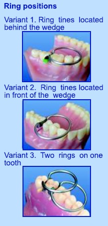 Matrici metalice interdentare tip PALODENT 1198 Matrici metalice interdentare tip PALODENT 1198 - imagine 5