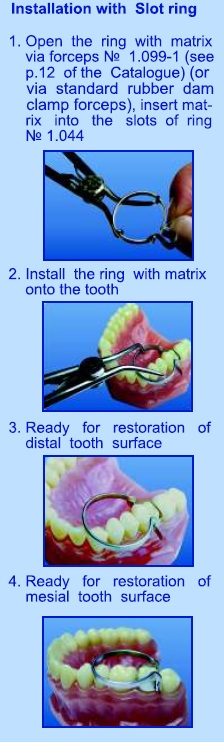 Matrici metalice interdentare tip PALODENT 1198 Matrici metalice interdentare tip PALODENT 1198 - imagine 6