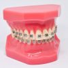 Model typodont orto roz cu bracketi metalici