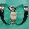 Folii de diga Rubber dam Dr.Mayer 36 buc