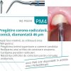 Anse gherute detartraj Satelec Acteon