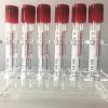 Eprubete A- PRF vacutainer 10ml Keymed Eprubete A- PRF vacutainer 10ml Keymed