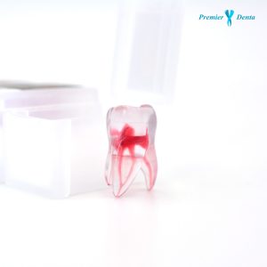 dinti-antremanent-acrilat-pvc-endodontie-anatoform