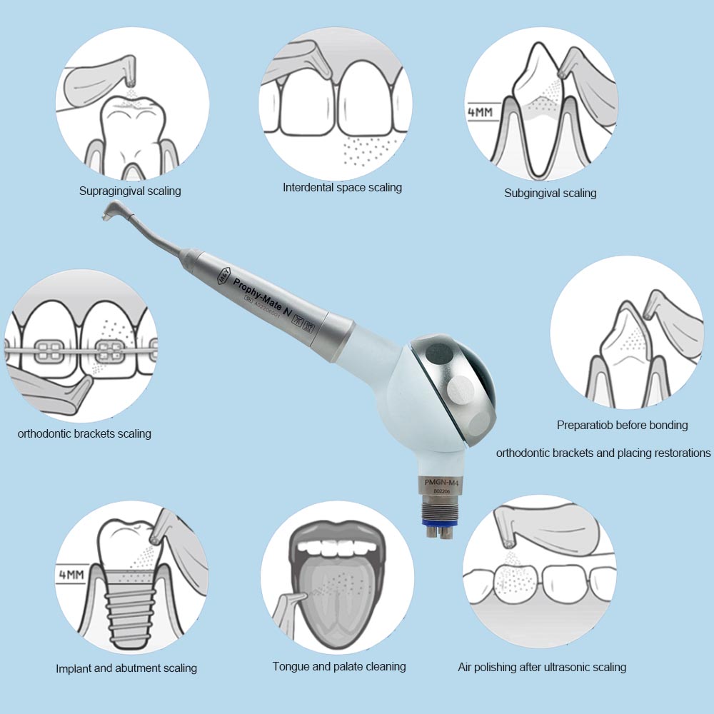 Air flow M&Y prophy mate N prophy jet dentar cu 2 varfuri Air flow M&Y prophy mate N prophy jet dentar cu 2 varfuri - imagine 9