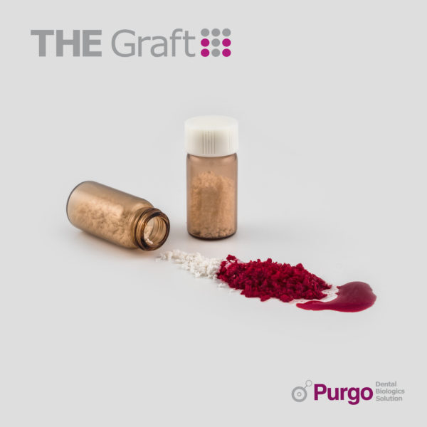 THE Graft™ – 3.6cc (1.00g) – 1.0-2.0mm os porcin grefa aditii osoase THE Graft™ – 3.6cc (1.00g) – 1.0-2.0mm os porcin grefa aditii osoase
