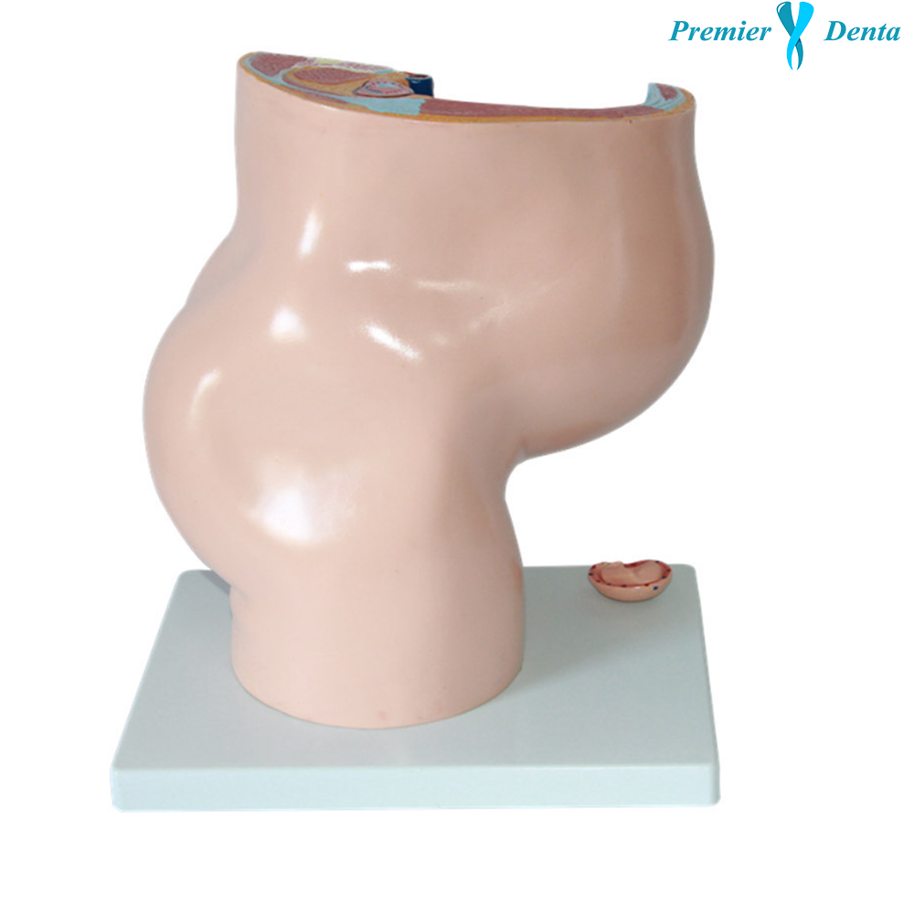 Model anatomic pelvis feminin in sarcina 4 parti sagital Model anatomic pelvis feminin in sarcina 4 parti sagital - imagine 2
